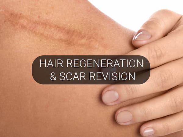 Hair Regeneration Course
